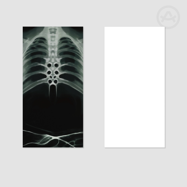 X is for X-Ray Print - HORROR ABC's